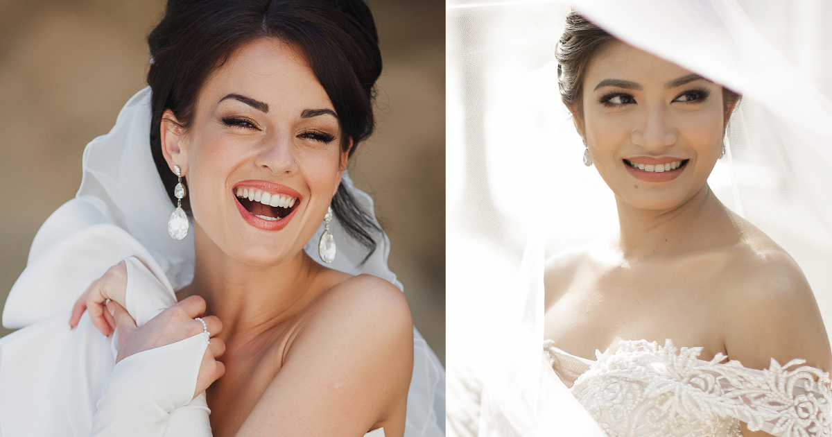 隱藏細節三：牙齒美白——微笑的焦點